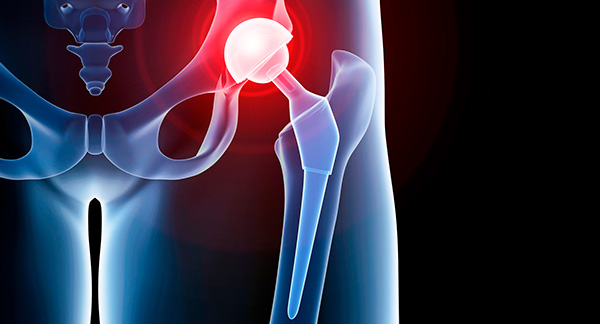 hip replacement in delhi